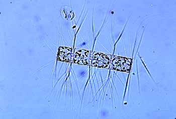 Bacteriastrum hyalinum. Photo by George Rowland
